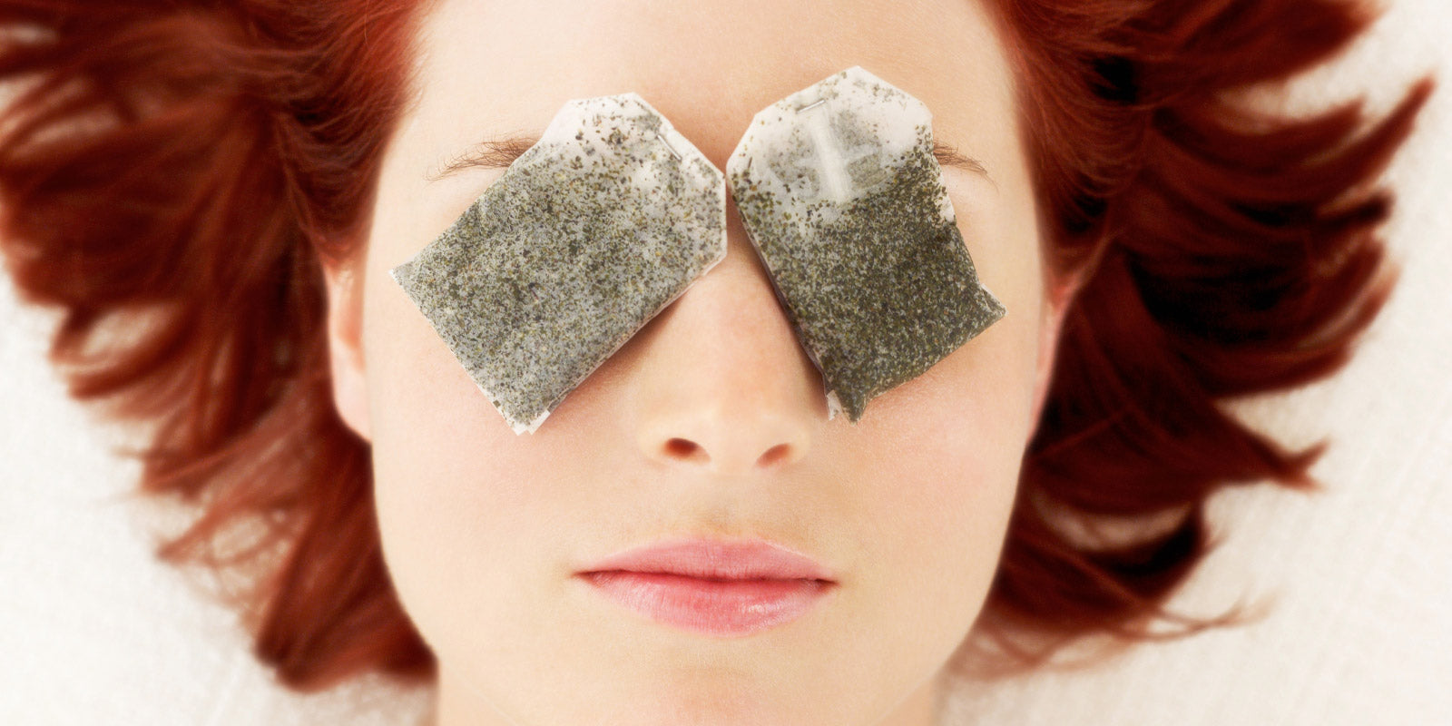 can ice get rid of dark circles under eyes