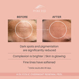 Glycolic Overnight Renewal Peel with Mandelic + Niacinamide (1oz/30ml)