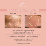 Glycolic Overnight Renewal Peel with Mandelic + Niacinamide (1oz/30ml)